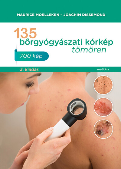 135 bőrgyógyászati kórkép tömören (új kiadás)