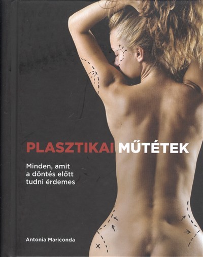 PLASZTIKAI MŰTÉTEK /MINDEN, AMIT A DÖNTÉS ELŐTT TUDNI ÉRDEMES